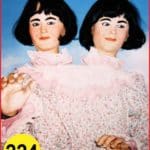 Siamese Twins Female Head or Face #224